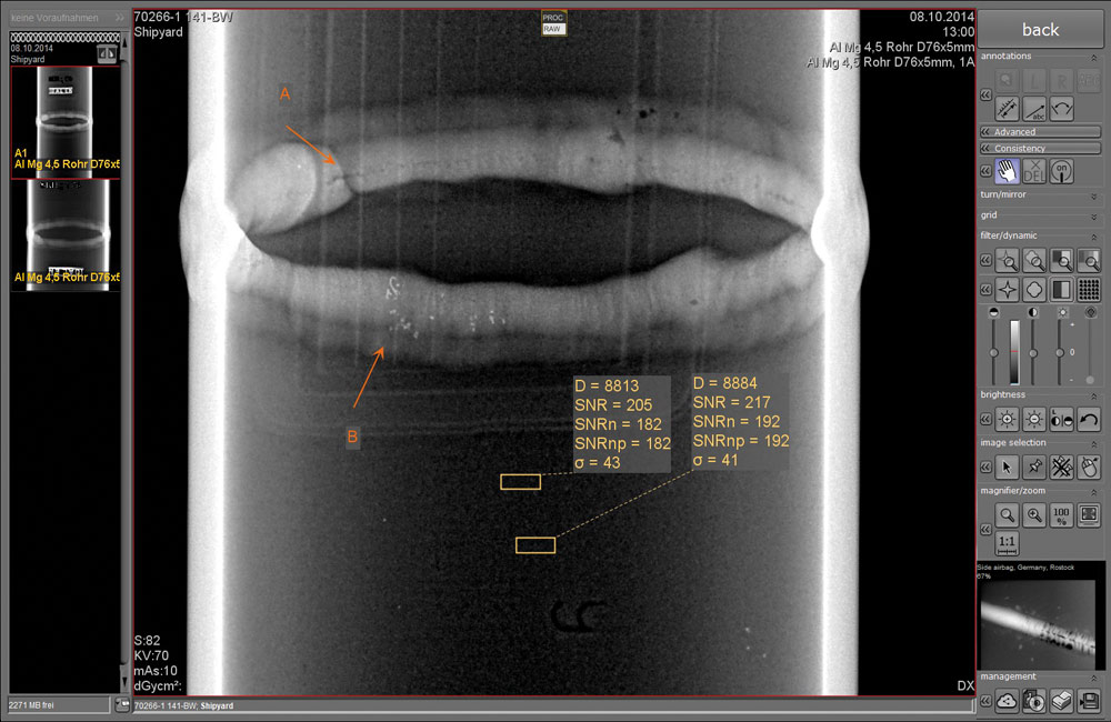 Gamma-Ray RT Imaging